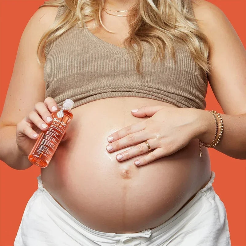 Bio-Oil Stretch Mark Prevention & Repair for Moms-to-Be